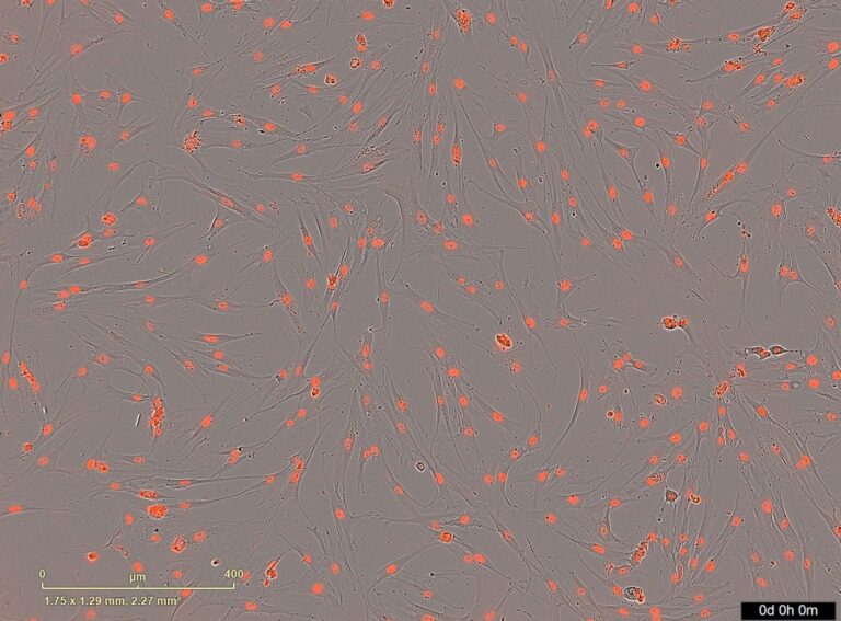 mesenchymal_stem_cells_20250822_182414.jpg