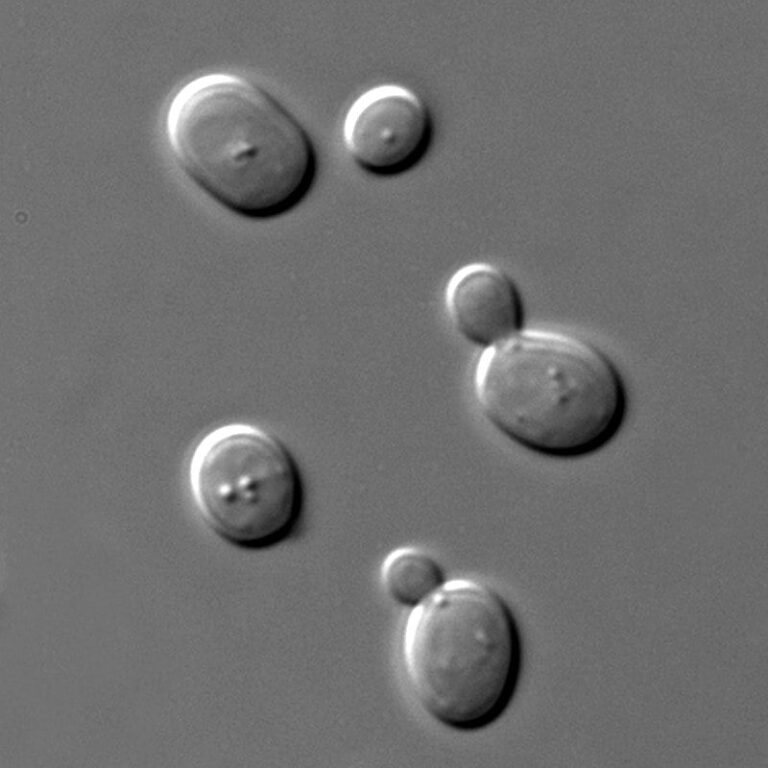 800px-S_cerevisiae_under_DIC_microscopy_20251015_114819.jpg