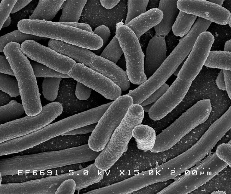 E._coli_Bacteria_7316101966_20260126_145053.jpg
